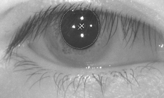 Eye Tracking Radiology Robust Eye Tracking Methods - 3D Visualization and Imaging Systems Lab ...