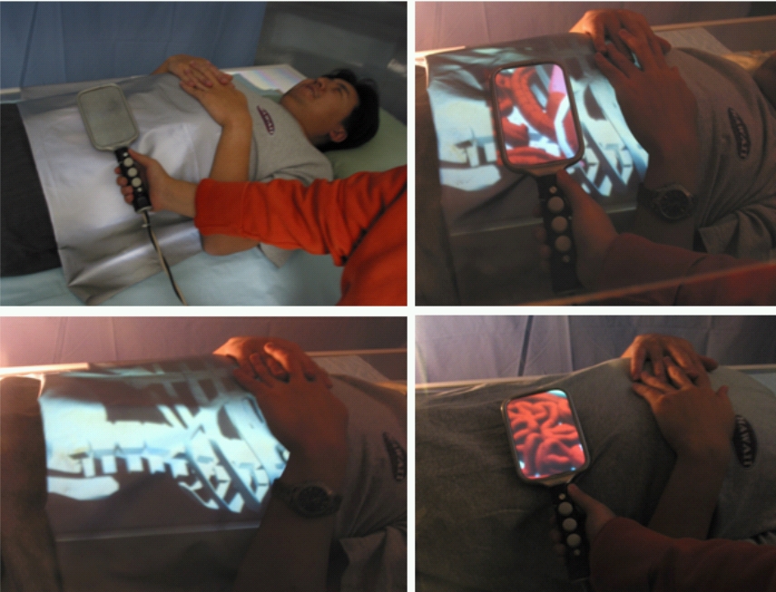 Medical Visualization - Magic Lens